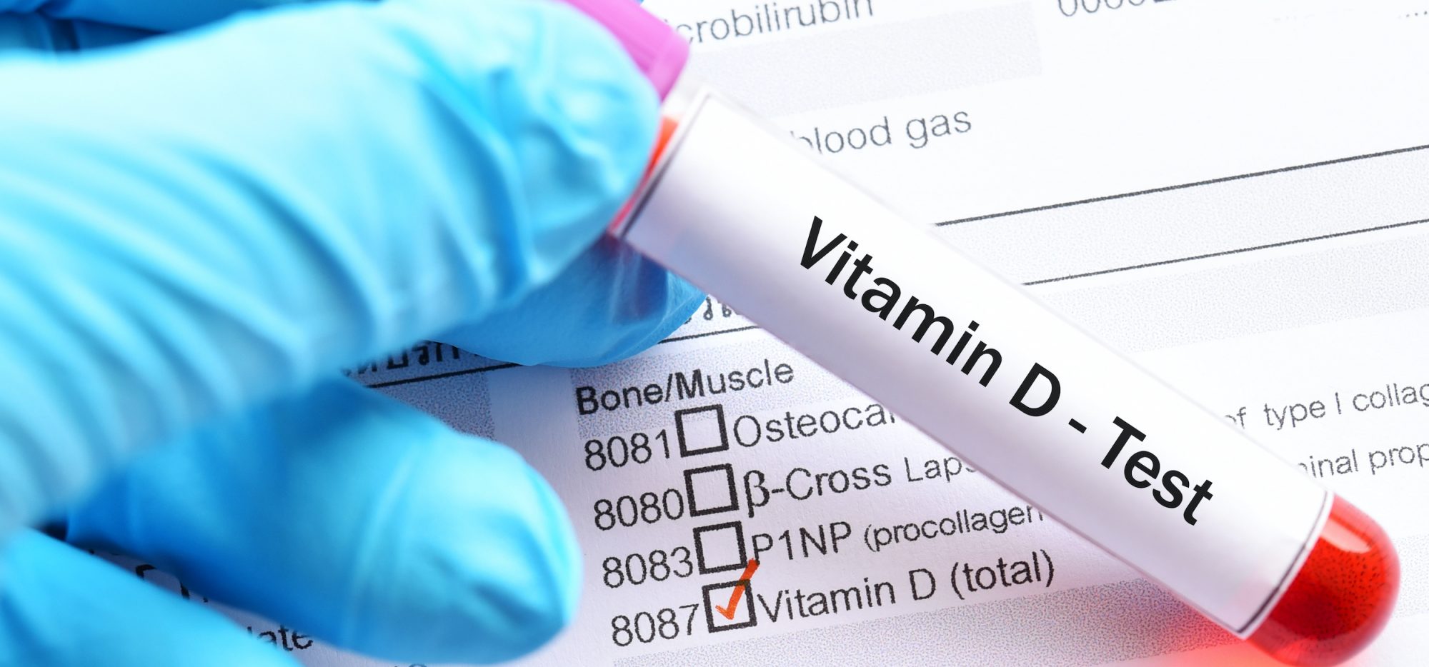 Ein Vitamin-D-Test-Röhrchen